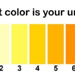 Why Urine is in Yellow Colour